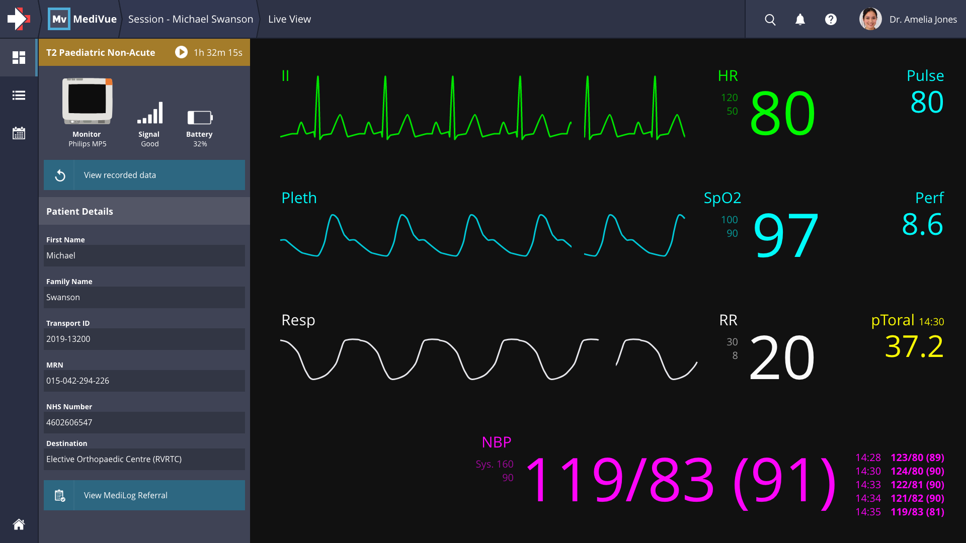 MediVue A screenshot of MediVue showing real-time waveforms for a patient monitor